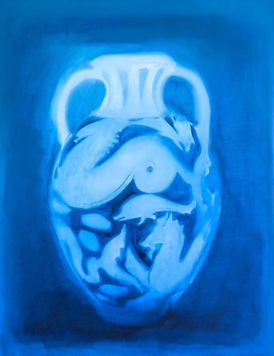 Amphora